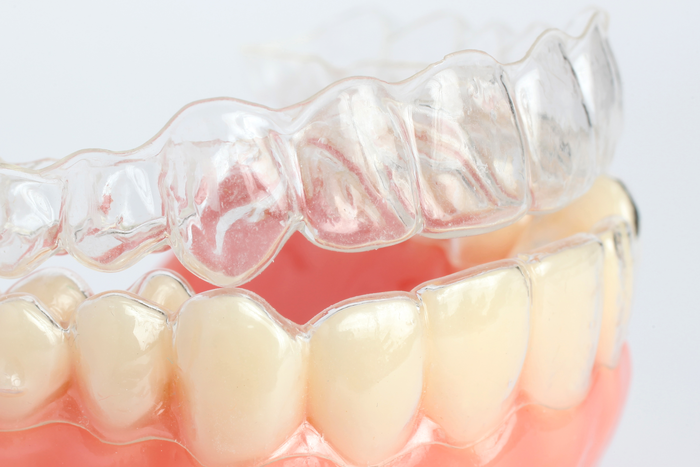たつみの歯科クリニックの歯ぎしり治療