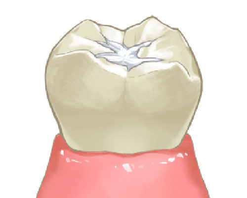 たつみの歯科クリニックの予防歯科治療